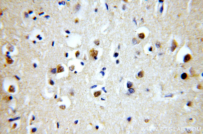 MPPED1 Antibody in Immunohistochemistry (Paraffin) (IHC (P))