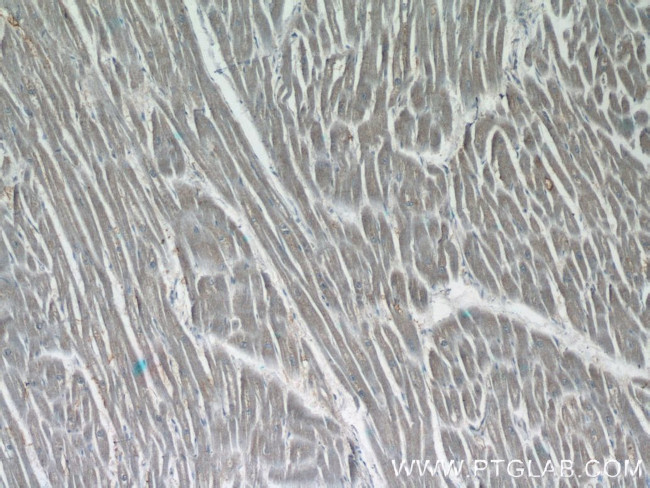 MPPED1 Antibody in Immunohistochemistry (Paraffin) (IHC (P))