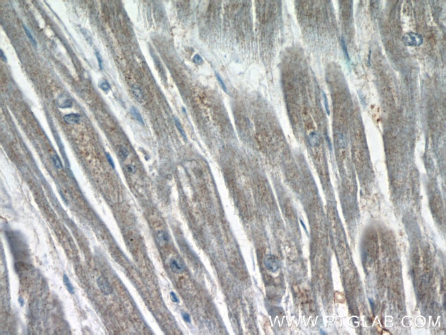 MPPED1 Antibody in Immunohistochemistry (Paraffin) (IHC (P))