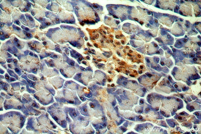 MPPED1 Antibody in Immunohistochemistry (Paraffin) (IHC (P))