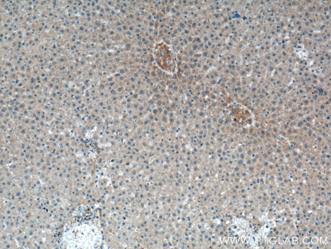 PIGA Antibody in Immunohistochemistry (Paraffin) (IHC (P))