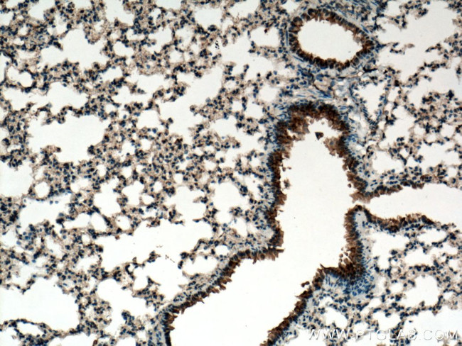 PIGA Antibody in Immunohistochemistry (Paraffin) (IHC (P))