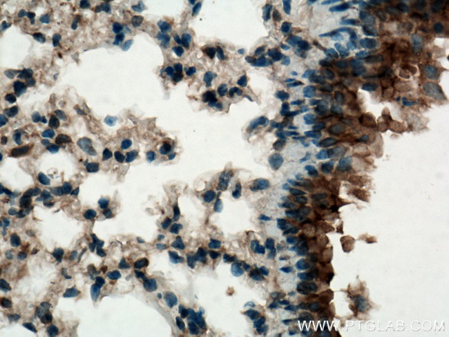 PIGA Antibody in Immunohistochemistry (Paraffin) (IHC (P))