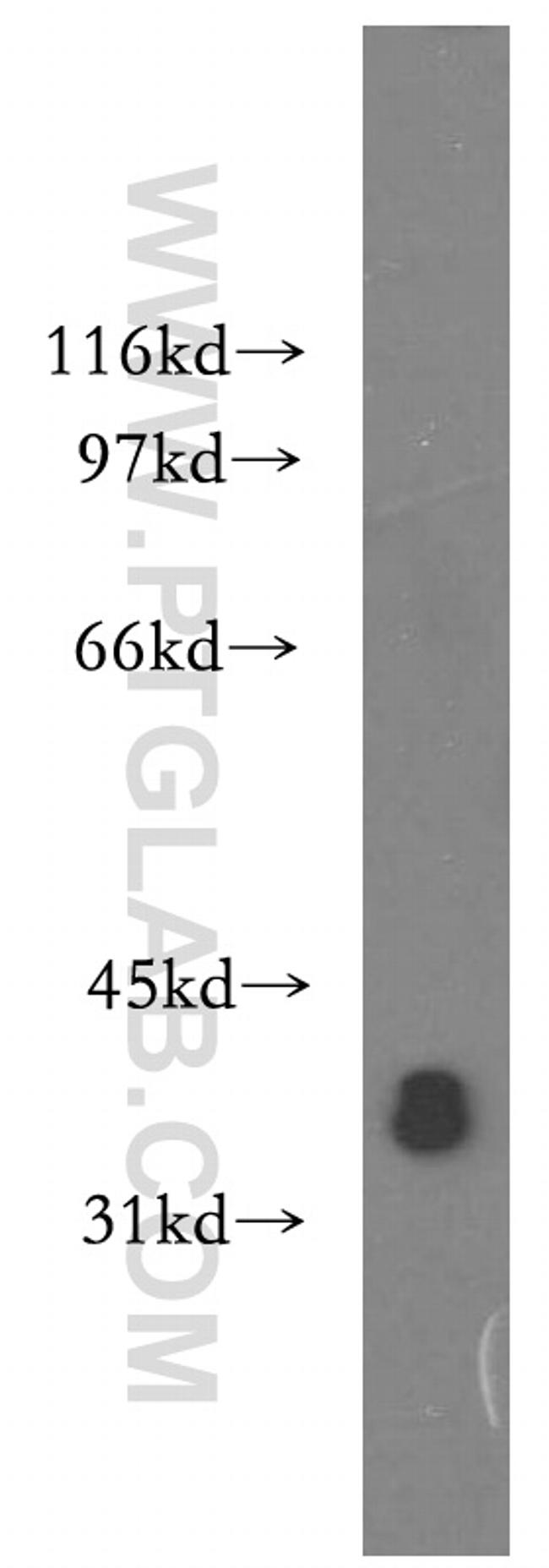 PIGA Antibody in Western Blot (WB)