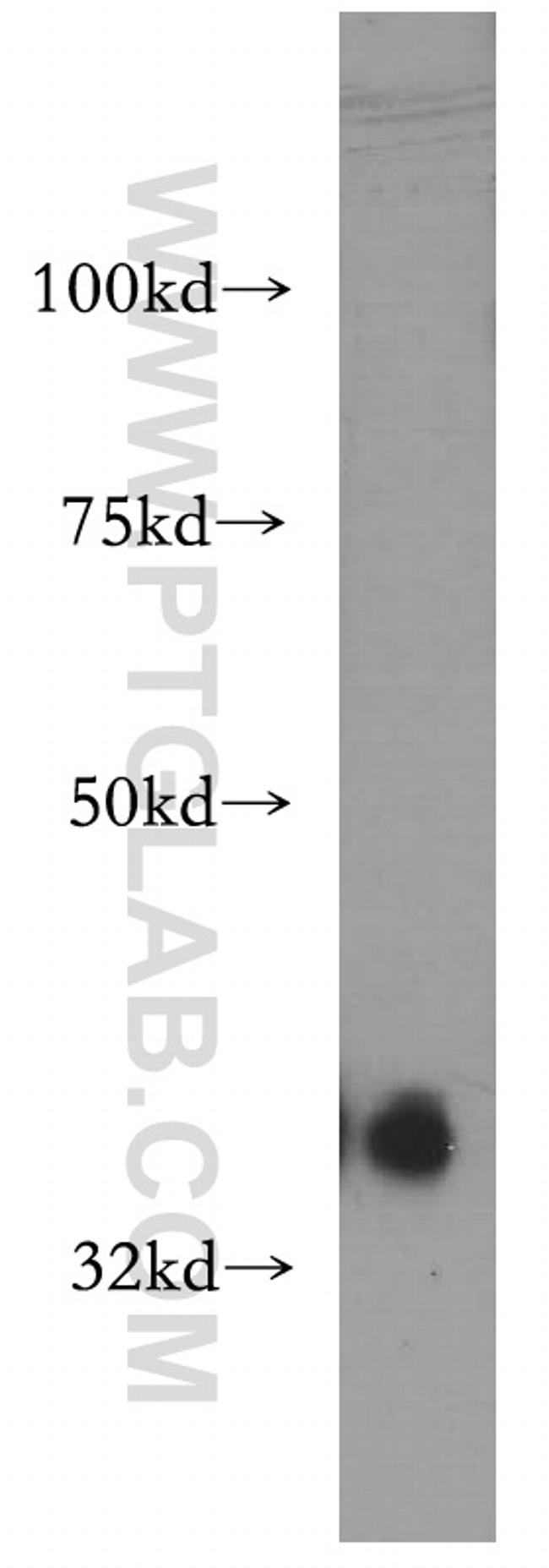 PIGA Antibody in Western Blot (WB)