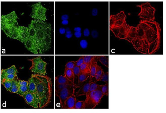 Transferrin Receptor Antibody in Immunocytochemistry (ICC/IF)