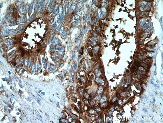 TFF2 Antibody in Immunohistochemistry (Paraffin) (IHC (P))