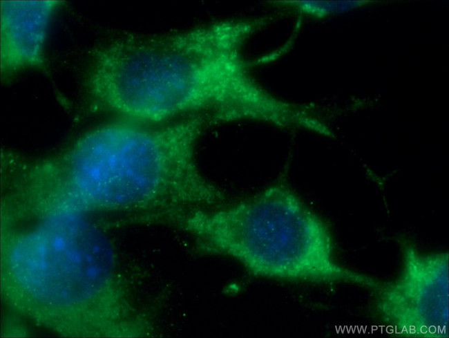 CHMP4B Antibody in Immunocytochemistry (ICC/IF)