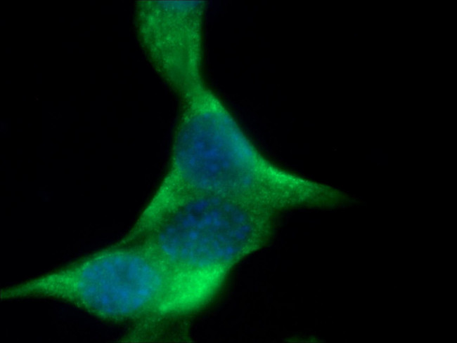 CHMP4B Antibody in Immunocytochemistry (ICC/IF)