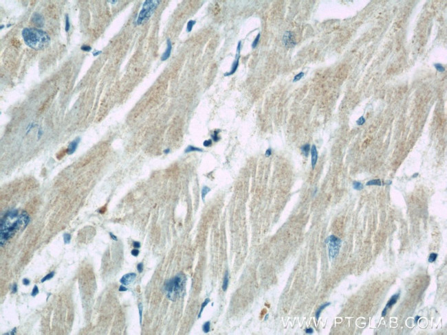 CHMP4B Antibody in Immunohistochemistry (Paraffin) (IHC (P))