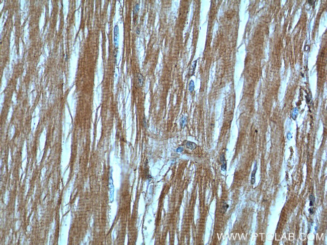 CHMP4B Antibody in Immunohistochemistry (Paraffin) (IHC (P))