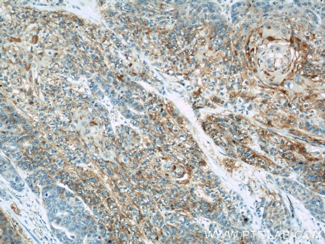 CHMP4B Antibody in Immunohistochemistry (Paraffin) (IHC (P))