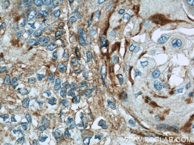 CHMP4B Antibody in Immunohistochemistry (Paraffin) (IHC (P))