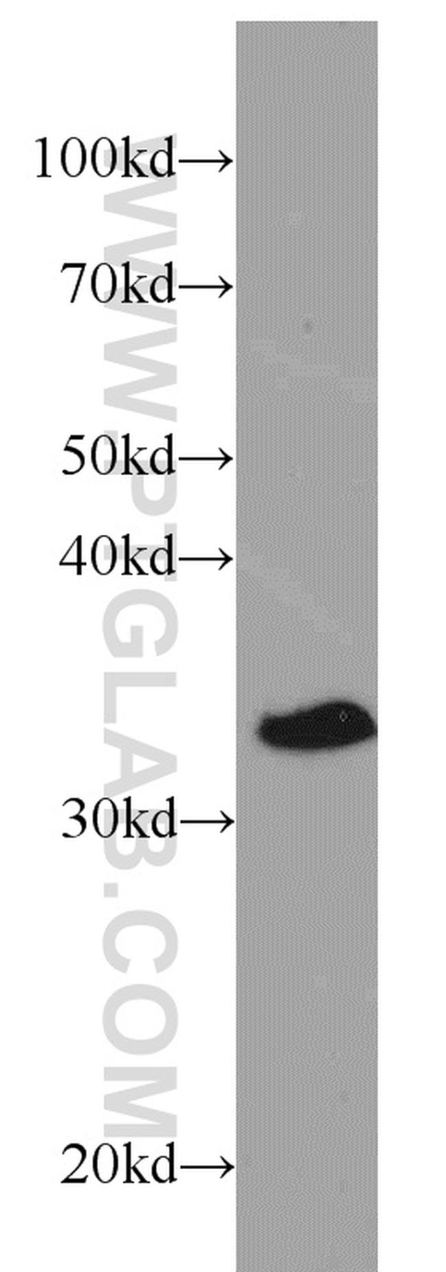 CHMP4B Antibody in Western Blot (WB)