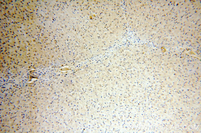 MTMR6 Antibody in Immunohistochemistry (Paraffin) (IHC (P))