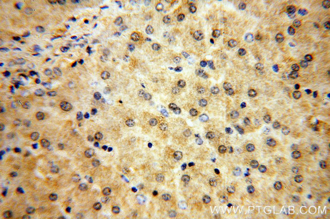 MTMR6 Antibody in Immunohistochemistry (Paraffin) (IHC (P))