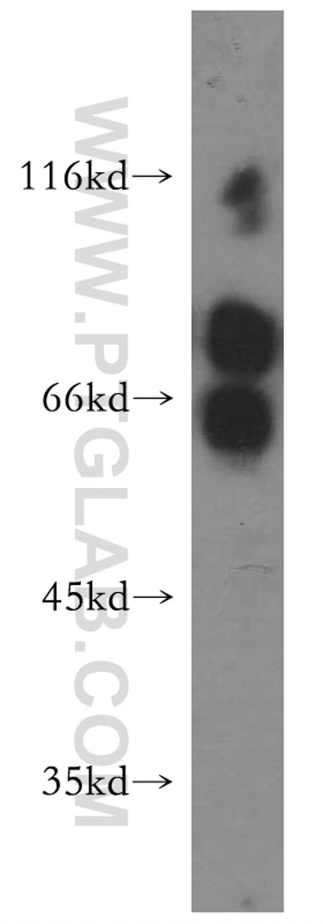 MTMR6 Antibody in Western Blot (WB)