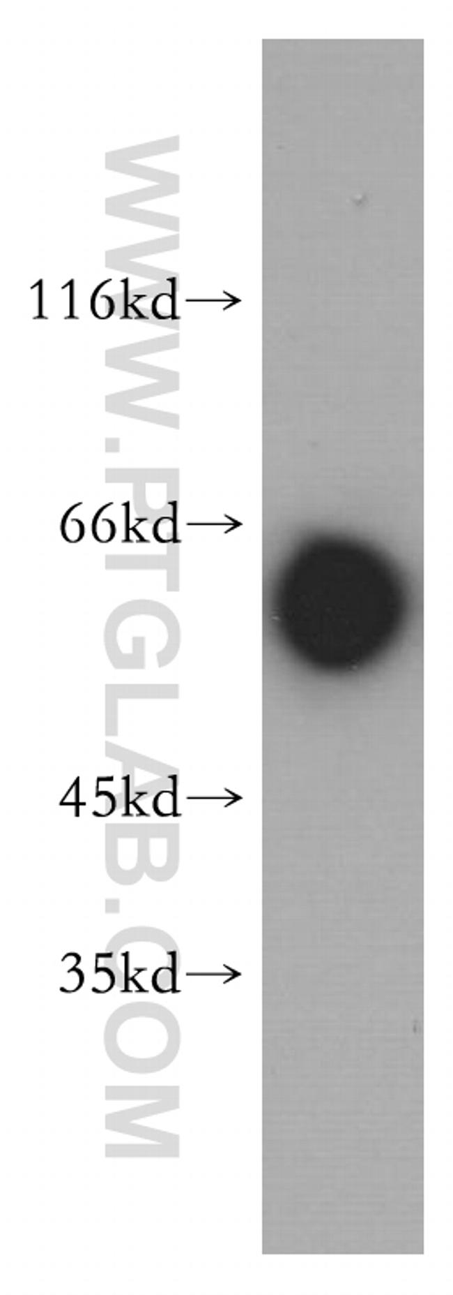 MTMR6 Antibody in Western Blot (WB)