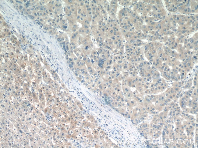 BCKDHB Antibody in Immunohistochemistry (Paraffin) (IHC (P))