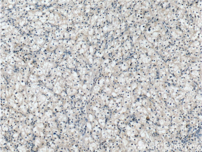 BCKDHB Antibody in Immunohistochemistry (Paraffin) (IHC (P))