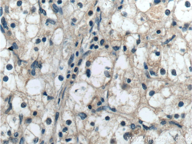 BCKDHB Antibody in Immunohistochemistry (Paraffin) (IHC (P))