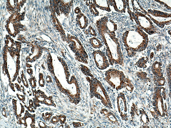 BCKDHB Antibody in Immunohistochemistry (Paraffin) (IHC (P))