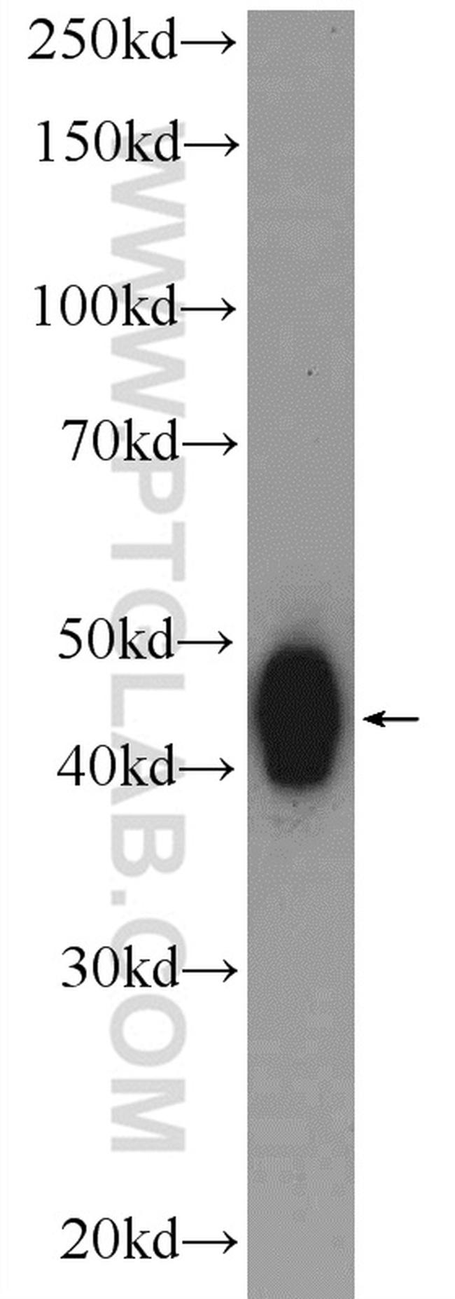 BCKDHB Antibody in Western Blot (WB)