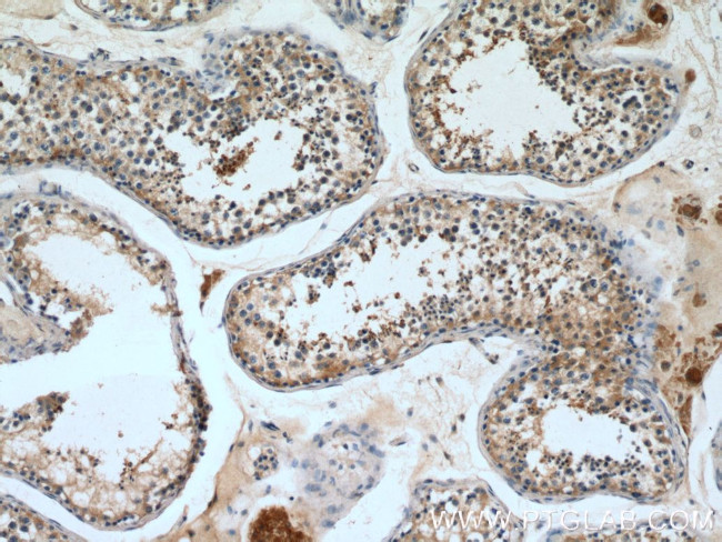 PGK2 Antibody in Immunohistochemistry (Paraffin) (IHC (P))