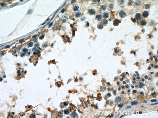 PGK2 Antibody in Immunohistochemistry (Paraffin) (IHC (P))