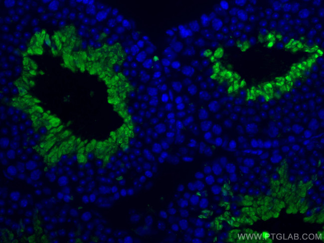 PGK2 Antibody in Immunohistochemistry (PFA fixed) (IHC (PFA))