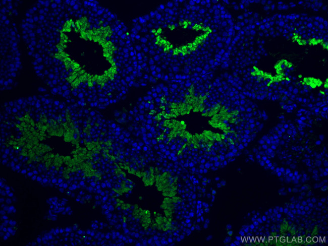 PGK2 Antibody in Immunohistochemistry (PFA fixed) (IHC (PFA))