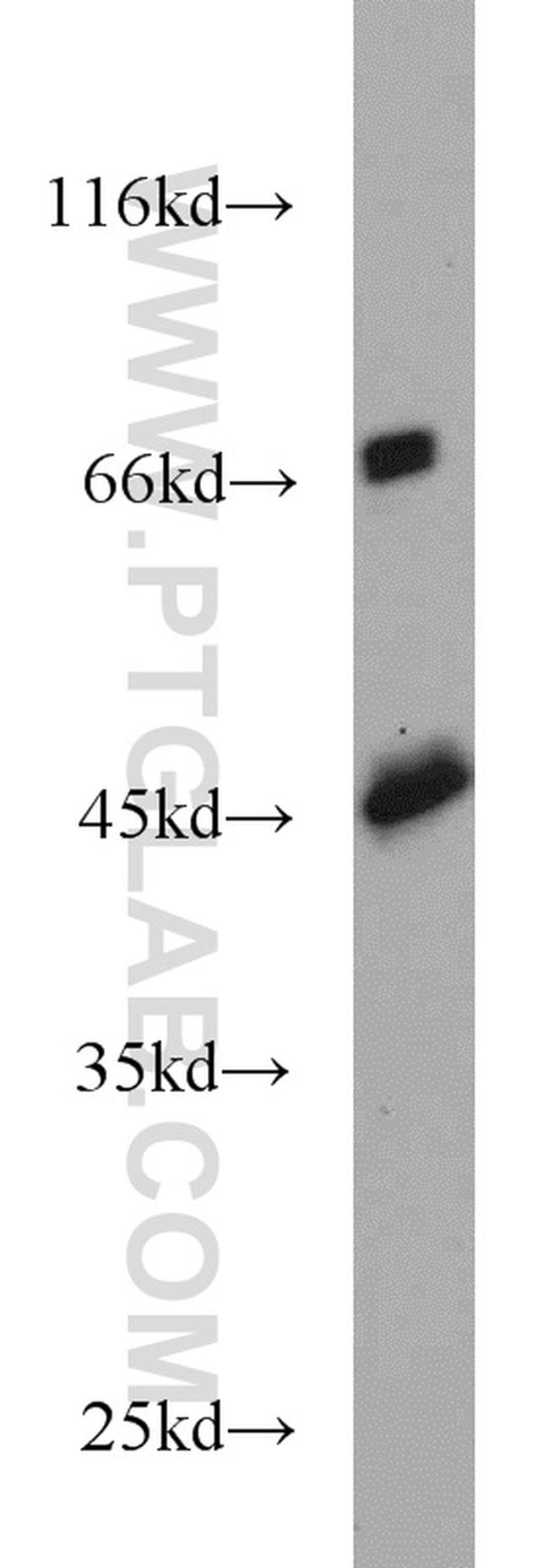 PGK2 Antibody in Western Blot (WB)