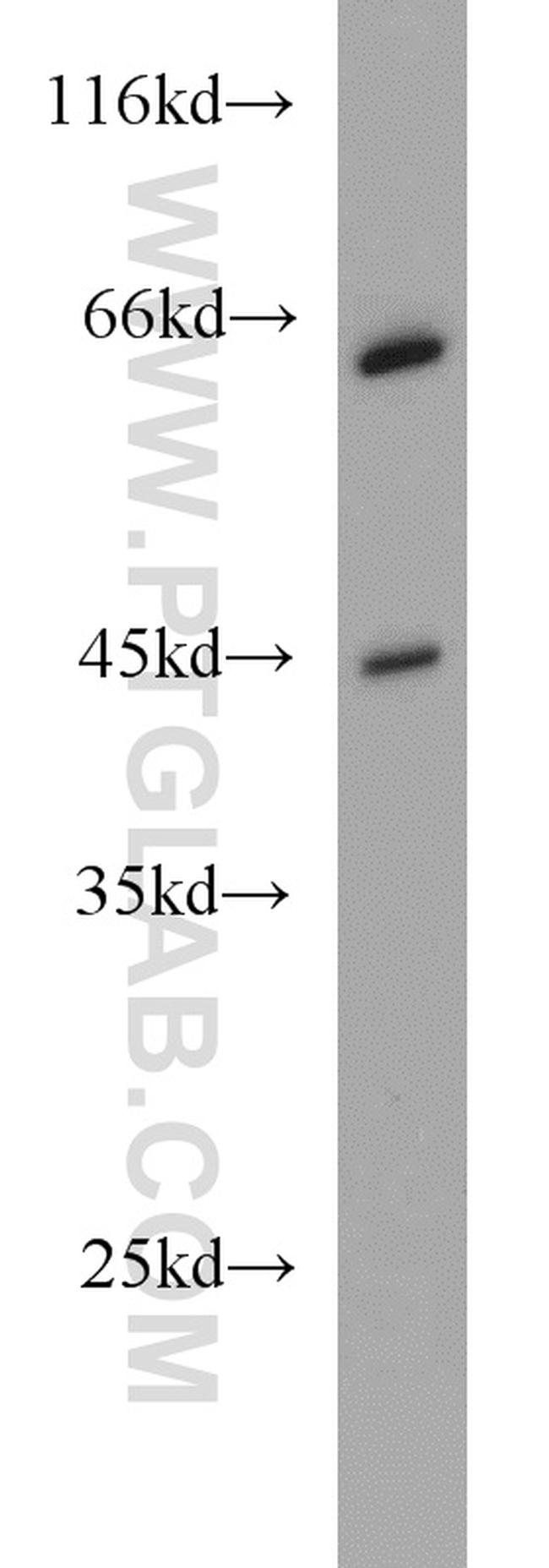 PGK2 Antibody in Western Blot (WB)