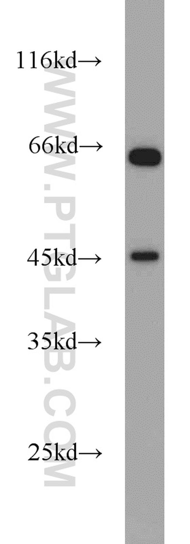 PGK2 Antibody in Western Blot (WB)