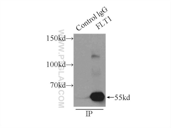 VEGFR-1/FLT-1 Antibody in Immunoprecipitation (IP)