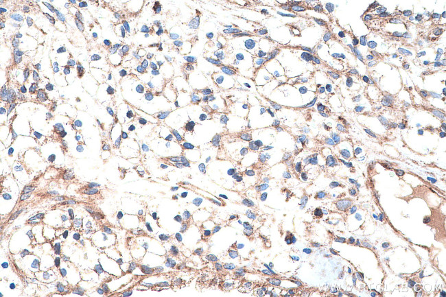 VEGFR-1/FLT-1 Antibody in Immunohistochemistry (Paraffin) (IHC (P))