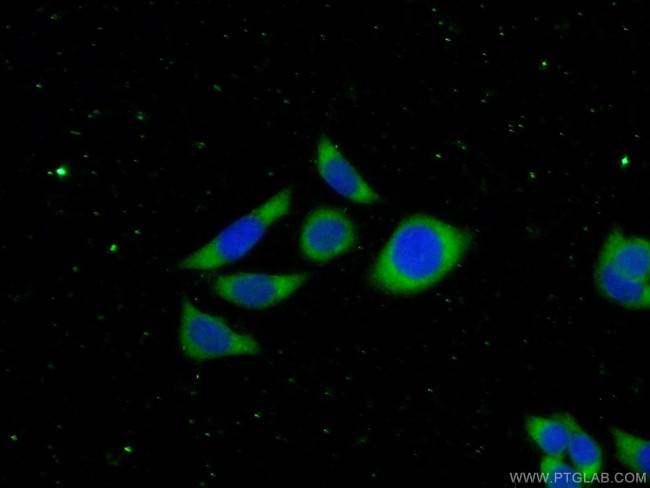 NEDD4L Antibody in Immunocytochemistry (ICC/IF)