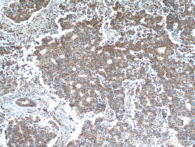 NEDD4L Antibody in Immunohistochemistry (Paraffin) (IHC (P))