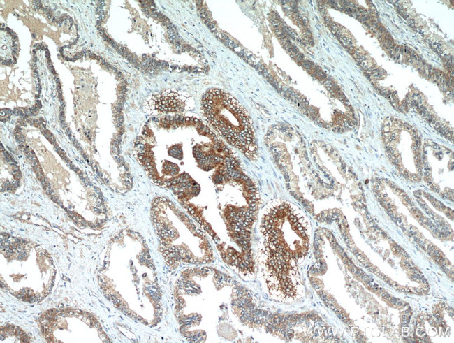 NEDD4L Antibody in Immunohistochemistry (Paraffin) (IHC (P))