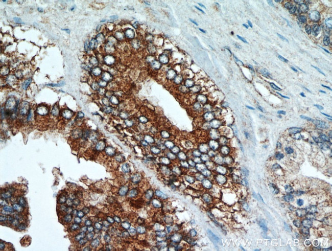 NEDD4L Antibody in Immunohistochemistry (Paraffin) (IHC (P))