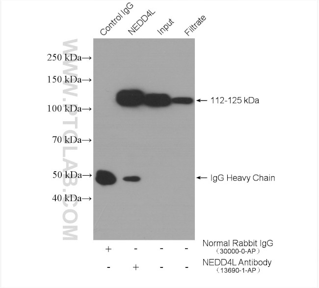 NEDD4L Antibody in Immunoprecipitation (IP)