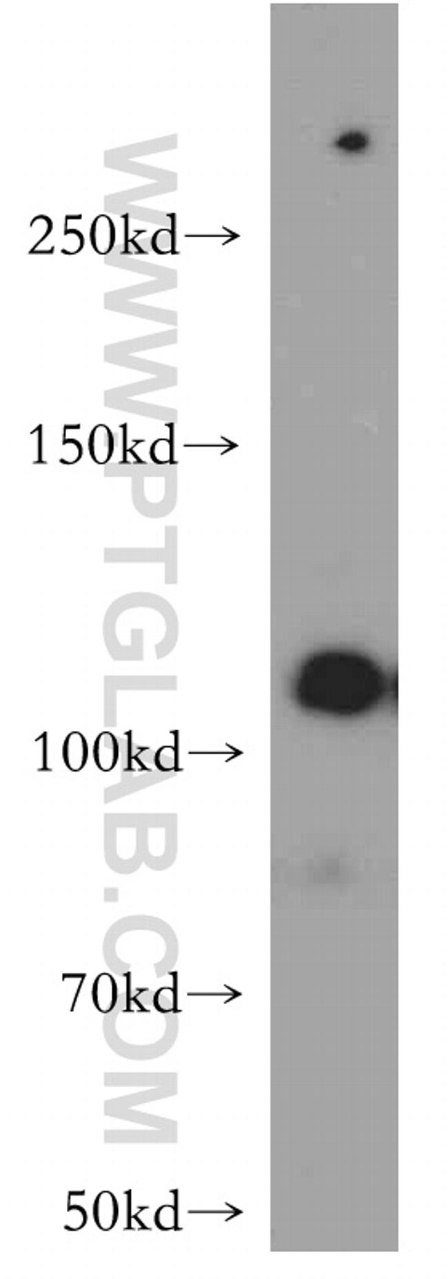 NEDD4L Antibody in Western Blot (WB)