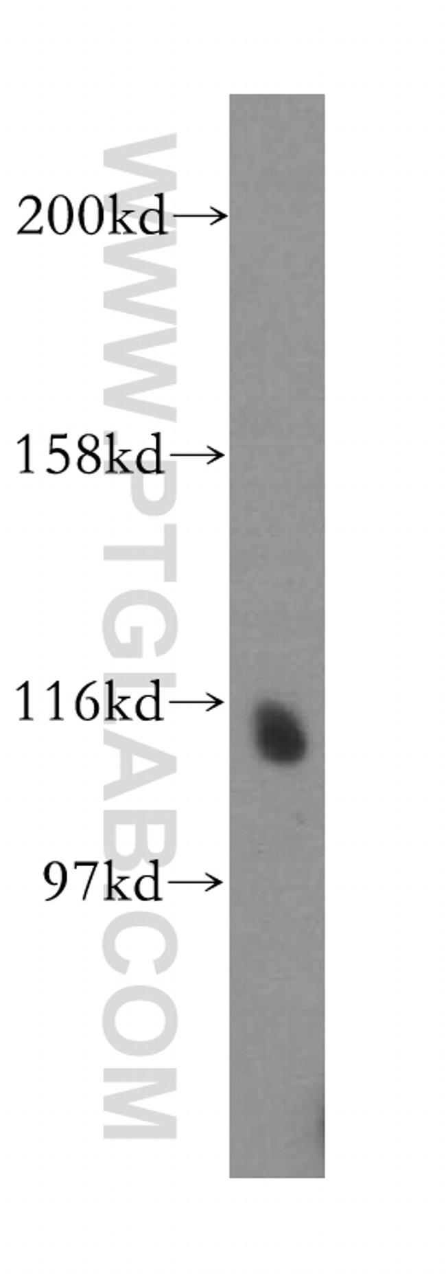 NEDD4L Antibody in Western Blot (WB)