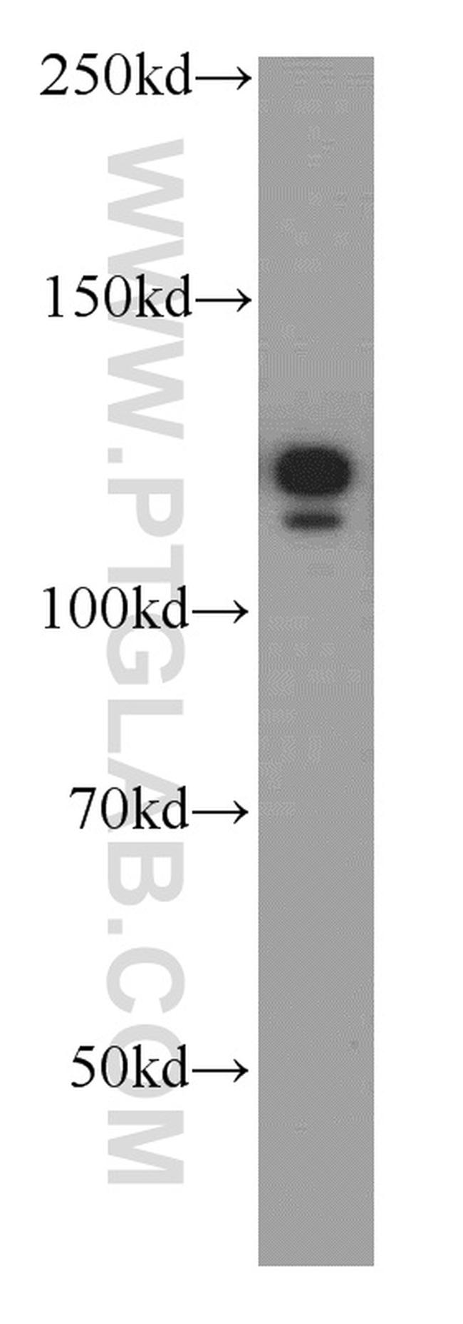 NEDD4L Antibody in Western Blot (WB)