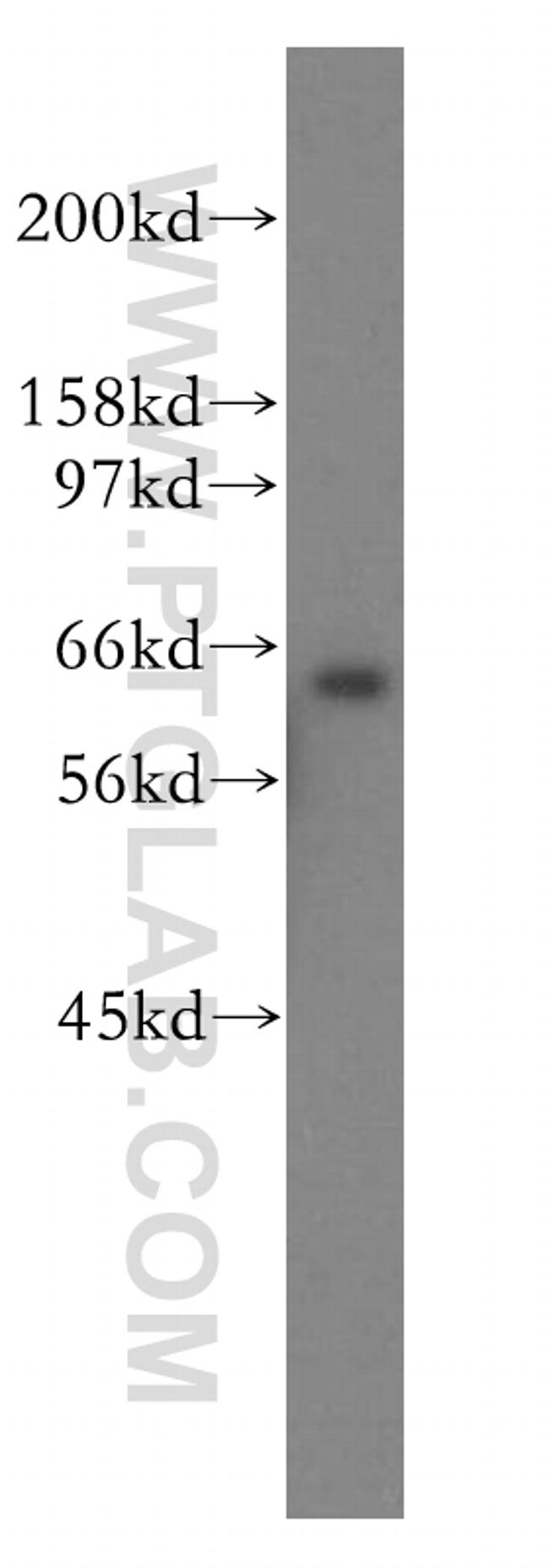 SSX2IP Antibody in Western Blot (WB)