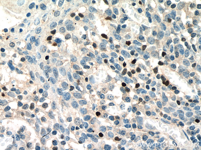 TBX21/T-bet Antibody in Immunohistochemistry (Paraffin) (IHC (P))