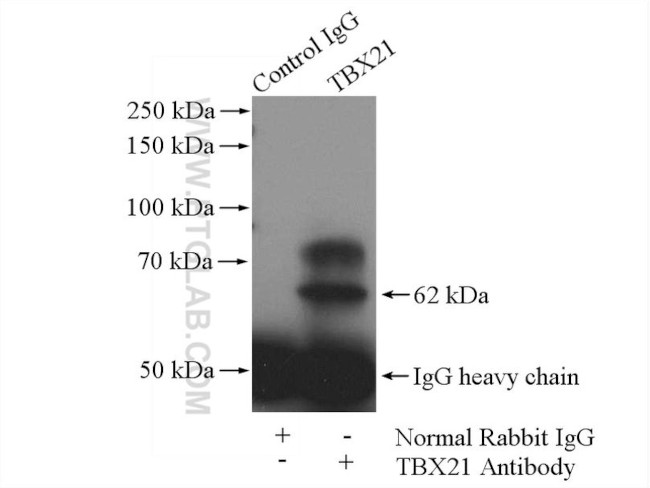 TBX21/T-bet Antibody in Immunoprecipitation (IP)