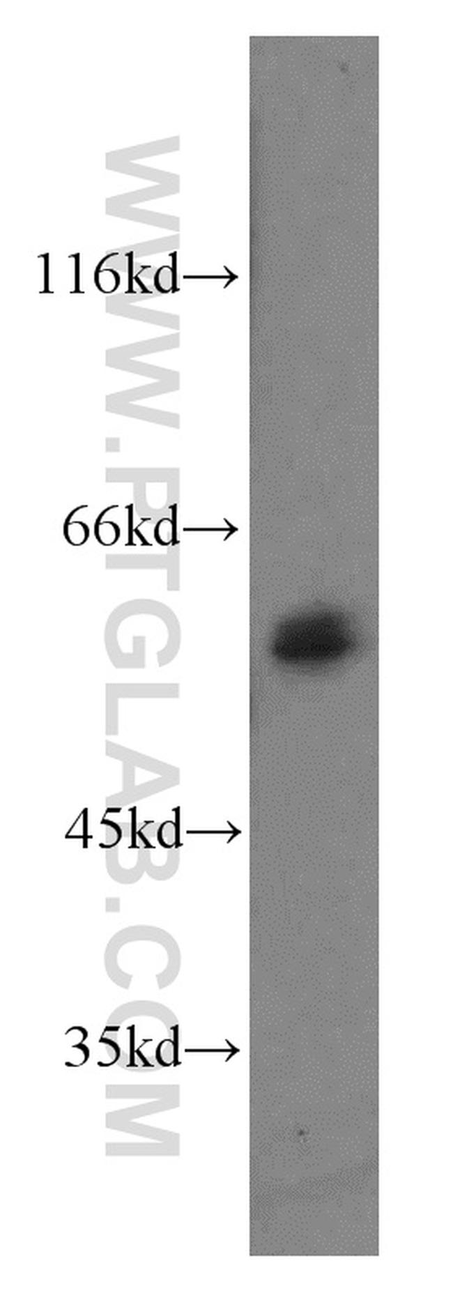 TBX21/T-bet Antibody in Western Blot (WB)