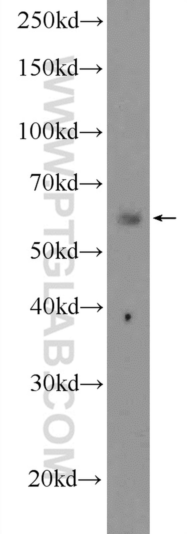 TBX21/T-bet Antibody in Western Blot (WB)