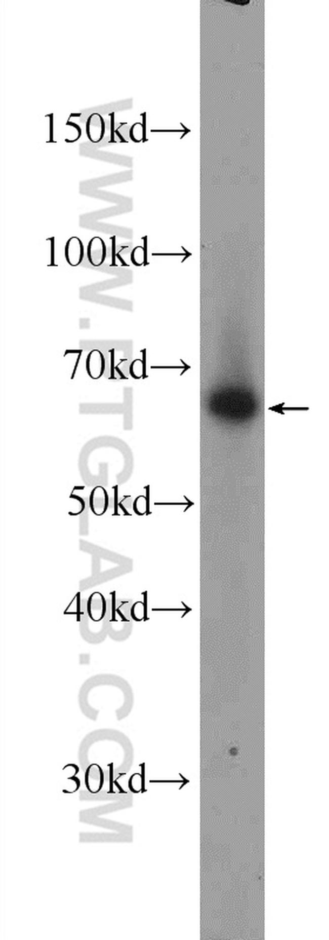 TBX21/T-bet Antibody in Western Blot (WB)